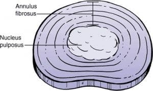 What a disc is made of